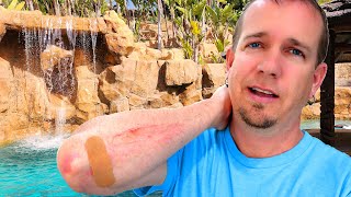 I Fall Off Water Slide Trying to Clean it!! Caught on Camera!