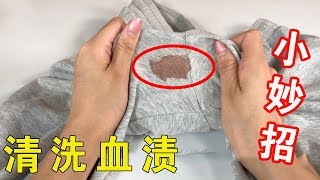 【生活小妙招】衣服上再頑固的血漬，用它一洗就掉，不留一點污痕，煥然一新 ！【生活小幫手安姐】