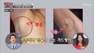 『겨드랑이』를 확인하라! 부종이 있다면 만.성.염.증(?) [내 몸 플러스] 185회 20200223