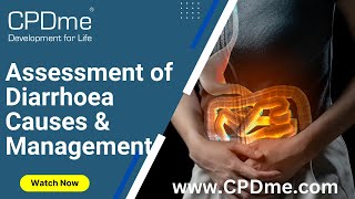 Assessment of Diarrhoea  Causes & Management Presented by Dr. Akash Doshi
