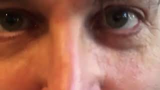 FxmMEkDtlpA