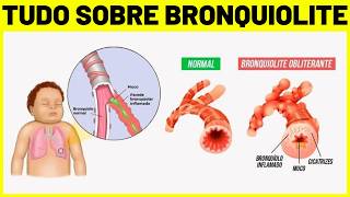 BRONQUIOLITE - O QUE É, CAUSAS, SINTOMAS E TRATAMENTO | Bronquiolite em bebês e crianças