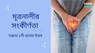 মূত্রনালী সংকীর্ণতা - প্রায়শই জিজ্ঞাসিত প্রশ্ন