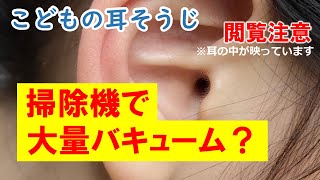 【こどもの耳かき】耳用の掃除機を使ってみた！　※手振れあり。酔いやすい方はご注意ください。