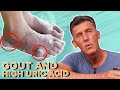 Keto and Carnivore's Biggest Fear: Gout and High Uric Acid