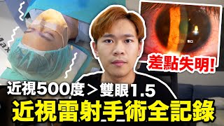 擺脫眼鏡人生❗️全飛秒近視雷射手術過程大公開👀❗️22秒就能重見天日❓真實心得分享｜超強系列 ft.大愛眼科