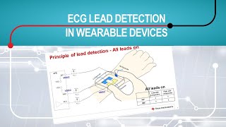 Electrocardiogram (ECG) lead detection in wearable devices