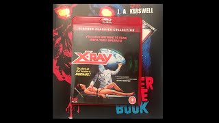 TheHORRORMan’s Slash Back Challenge Week 7 - X-Ray / Hospital Massacre - Horror Movie Review