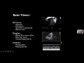 neonatal functional echo normal views and how to find echo windows