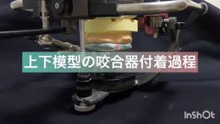 上下模型の咬合器付着模型について院長が解説！