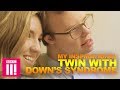My Inspirational Twin With Down's Syndrome | Living Differently