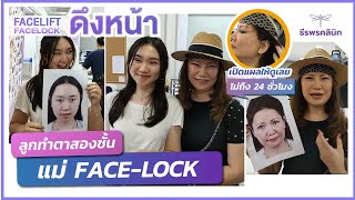 สาวปักกิ่ง ดึงหน้า Face-Lock ทำไม่ถึง 24 ชั่วโมง พร้อมลูกสาวทำตาสองชั้น!!!!