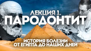 КАК ВЫЛЕЧИТЬ ПАРОДОНТИТ? История болезни. Методы лечения. Лечение десен и зубов.