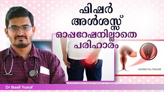 ഫിഷർ ഓപ്പറേഷൻ ഇല്ലാതെ മാറ്റാം | Fissure Treatment Without Surgery | Dr.Basil's Health Tips