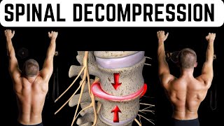 Spinal Decompression Exercise for Sciatica and Back Pain