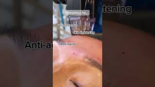 Morpheus8 (Microneedling + Radiofrequency) Results
