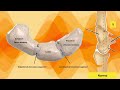 understanding carpal instability disi visi dorsal u0026 volar intercalated segment instability