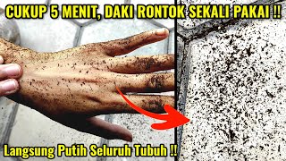 CUKUP 5 MENIT DAKI LANGSUNG RONTOK SEKALI PAKAI | CARA MENGHILANGKAN DAKI CEPAT \u0026 ALAMI #wulanhusna