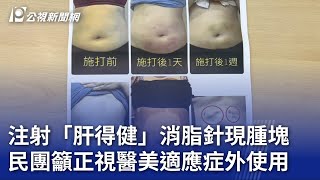 注射「肝得健」消脂針現腫塊 民團籲正視醫美適應症外使用｜20230714 公視晚間新聞