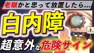 放置厳禁！絶対に見逃さないで！知らないと後悔する白内障の危険な3つの症状とは？