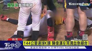 144公里速球K頭 陳偉漢左耳濺血急縫合｜TVBS新聞