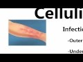 Cellulitis