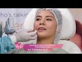 ULTHERAPHY AND MESOTHERAPY FOR DOUBLE CHIN