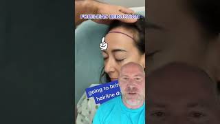 Forehead Reduction Surgery Shorts