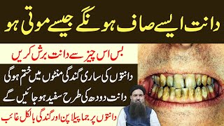 Teeth Whitening & Cleaning Fast at Home in Urdu | Danton Ko Safed Karne Ka Tarika Dr Sharafat Ali
