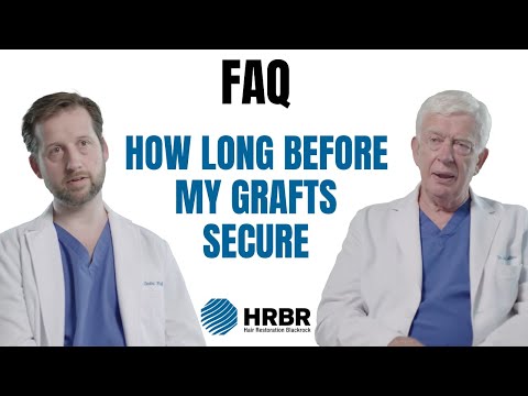 FAQ: How long after my hair transplant are my grafts secure? – Rochenoire hair restoration