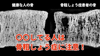 骨粗しょう症の予防！15のチェックで骨の健康度を知るべし！！【豆知識】