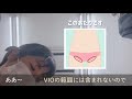 湘南美容クリニックのvio脱毛を受けてみました！