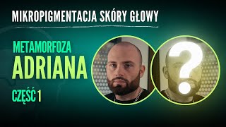 Metamorfoza Adriana - przed zabiegiem mikropigmentacji skóry głowy