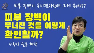 [시청자 질문] 피부 장벽이 무너진 것이 뭔가요?