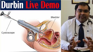 पेशाब की नाली खोलने की दूरबीन | Cystoscopy & Urethrotomy (OIU) in Hindi