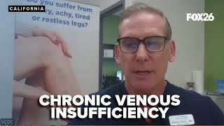 How to treat Chronic Venous Insufficiency