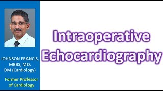 Intraoperative Echocardiography