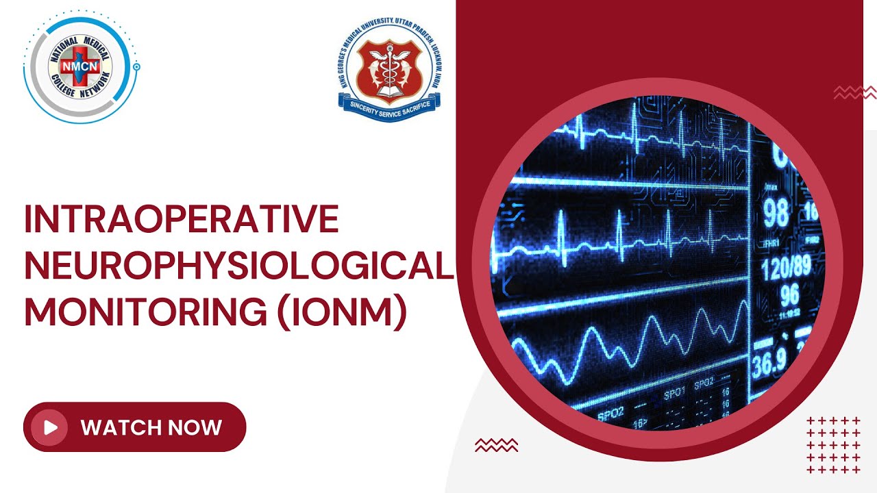 Intraoperative Neurophysiological Monitoring (IONM) - YouTube