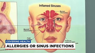 Allergies or sinus infection?