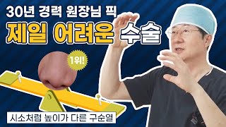 [구순열] 내 코가 시소처럼 삐뚤어졌다고? 그리고.. | 심미안의원