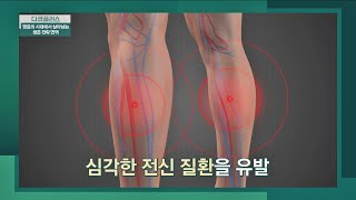 우리 몸의 시한폭탄💣 '만성염증'이 지속될 시 심각한 전신 질환 유발😰 다큐 플러스(docuplus) 216회 | JTBC 220522 방송