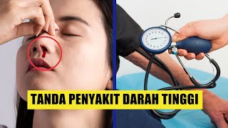 SERING DIABAIKAN! Ini 11 Gejala Hipertensi