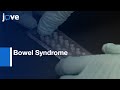 Bowel Syndrome related miRNAs Detected by MGE | Protocol Preview