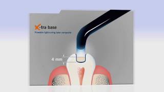 VOCO x-tra base bulk fill posterior base composite