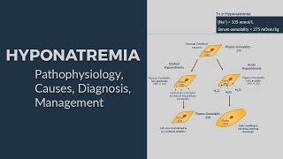 Hyponatremia - Pathophysiology, Causes, Diagnostic Approach \u0026 Management 😊 (All-in-One Package) 😊