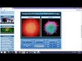 confocal vs widefield difference in image quality