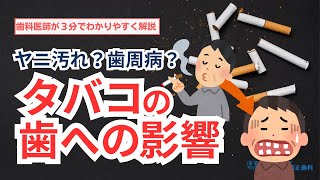 【タバコの歯への影響】100害あって1利なし！？タバコがお口の健康にどれだけ悪影響なのか歯科医師が3分間でわかりやすく解説！