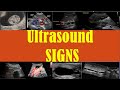 Top 50 ultrasound signs every radiologist should know!!