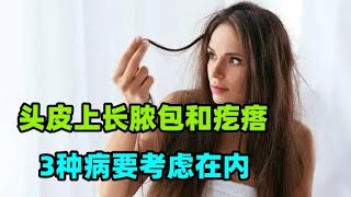 为什么头皮上经常长脓包和疙瘩？医生提醒：3种病要考虑在内#为何“肺结节”越来越多？医生劝说：3种食物少碰，肺会感谢你