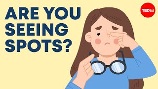 What are those spots you see after you rub your eyes? - Paul CJ Taylor